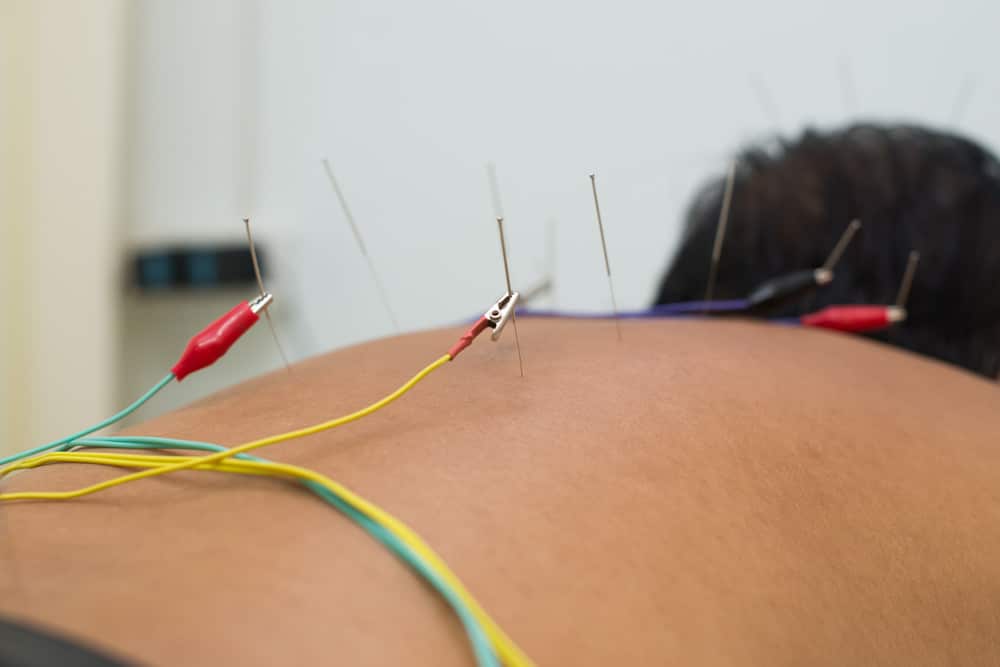 Electrical Stimulation